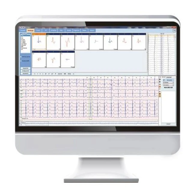 Software Holter ECG BIOMEDICAL V 1.05