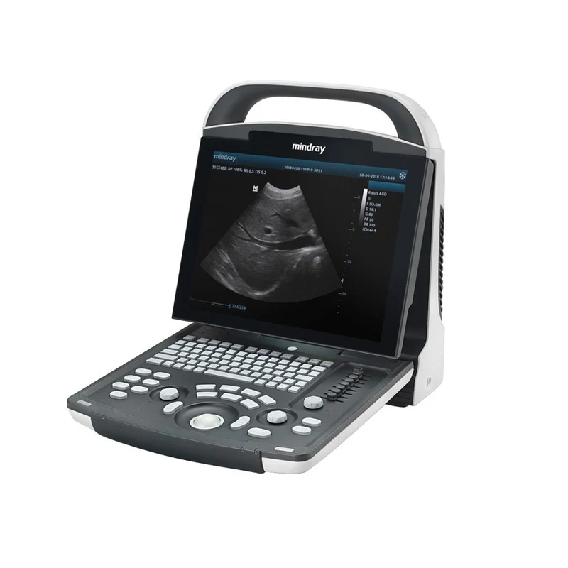 Ecografo portatile MINDRAY DP10 nuova versione - senza sonde + Doppler Pulsato