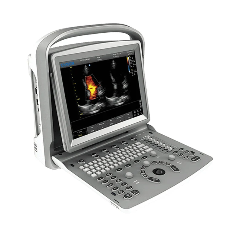 Ecografo Color-Doppler portatile CHISON ECO6 - senza sonde