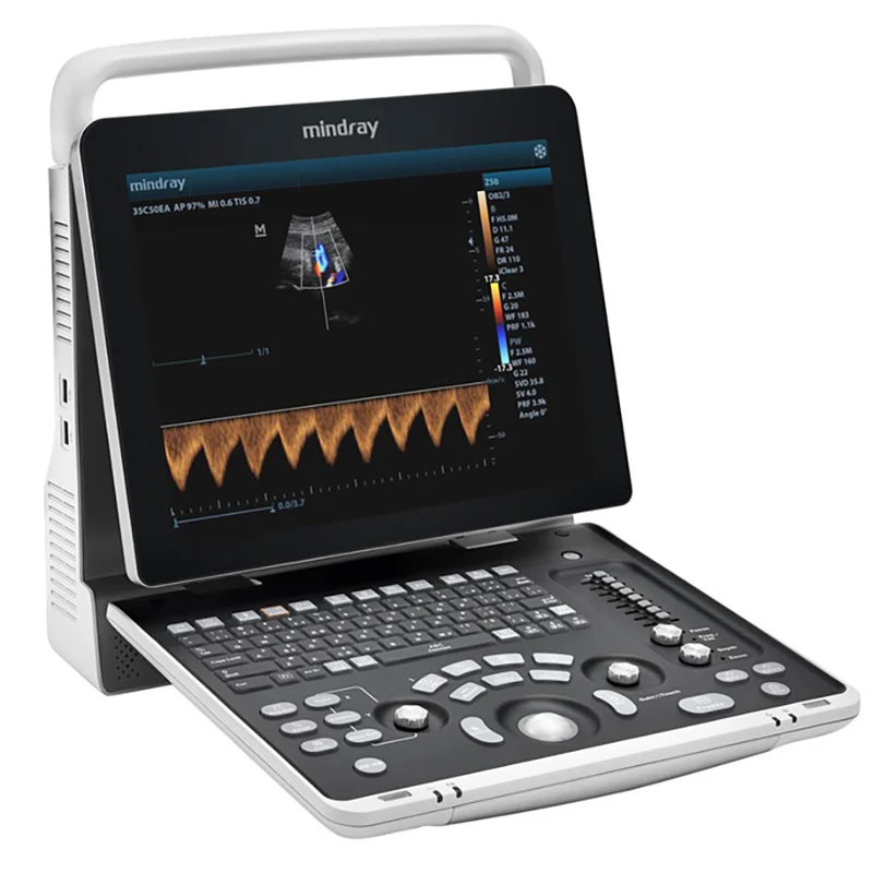 Ecografo Color-Doppler portatile MINDRAY Z50 - senza sonde