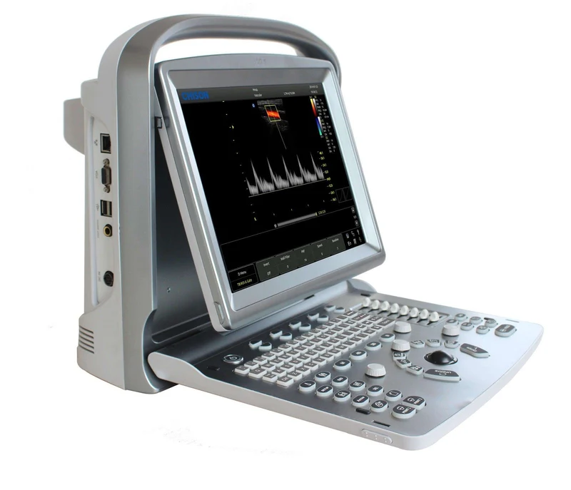 Ecografo Color-Doppler portatile CHISON ECO5 - senza sonde